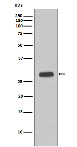 Troponin I Rabbit mAb