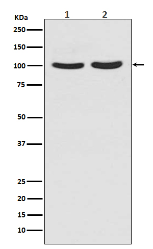 Androgen Receptor Rabbit mAb