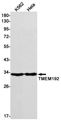 TMEM192 Rabbit mAb