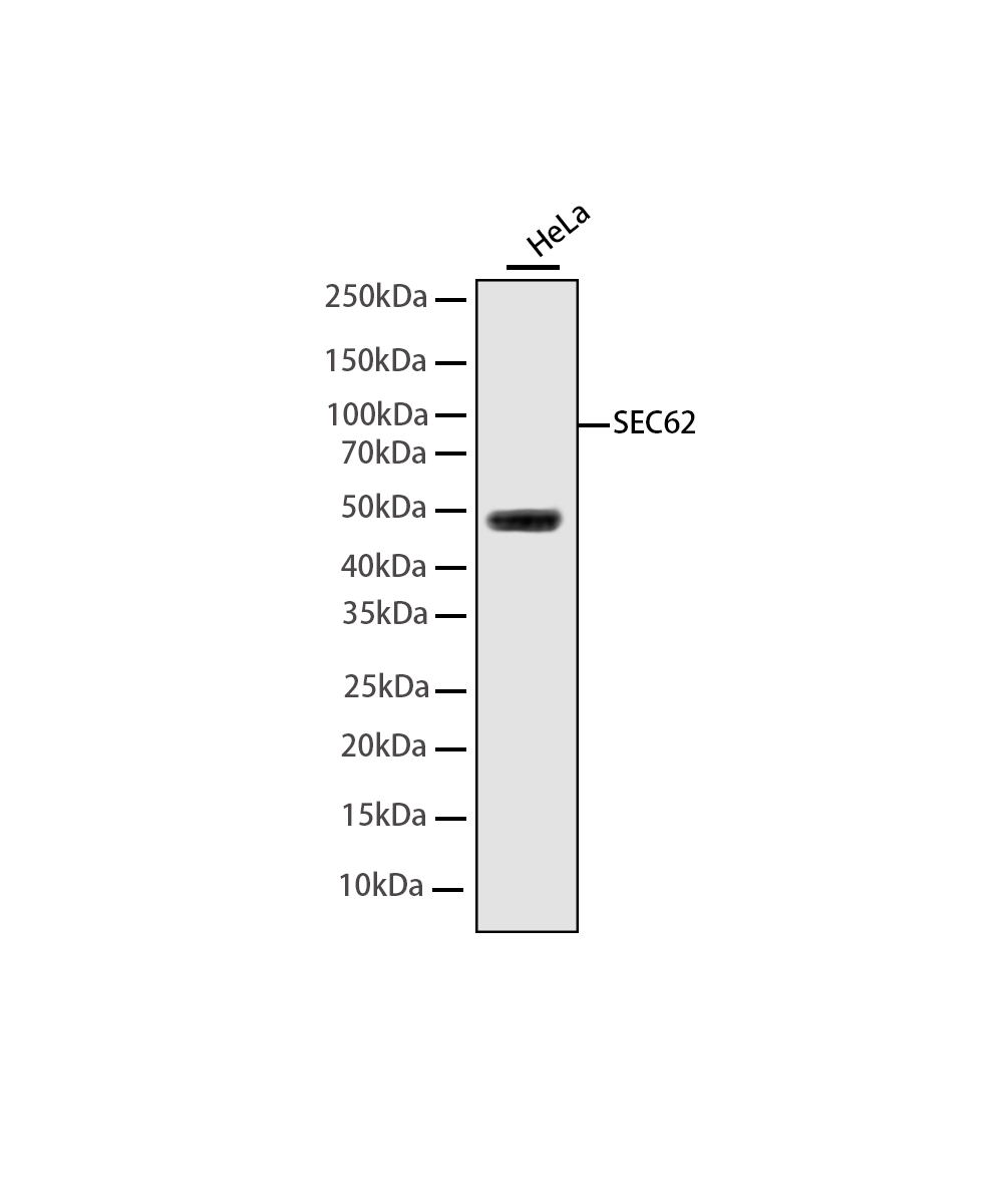 SEC62 Rabbit mAb