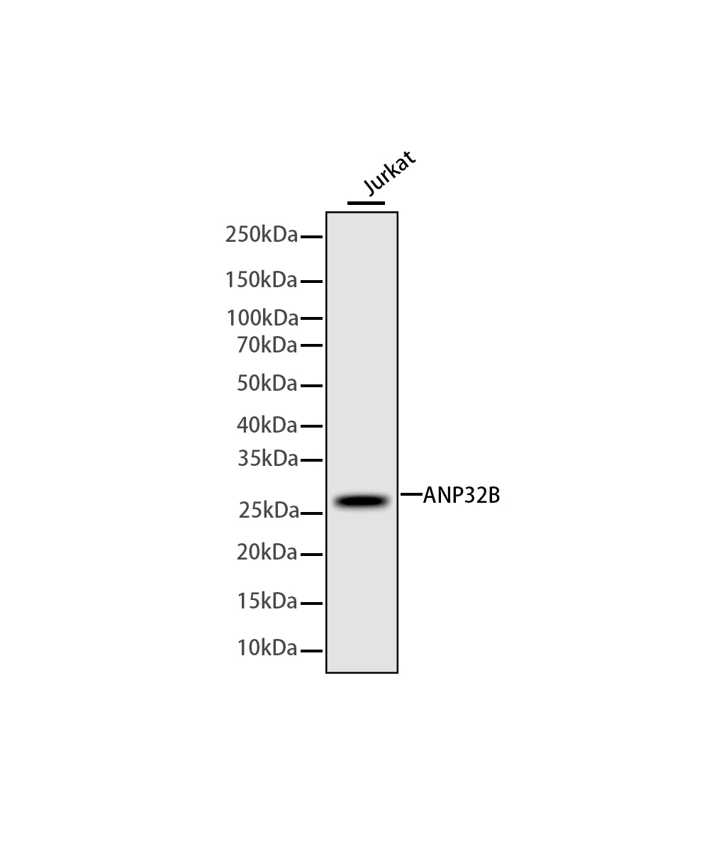 ANP32B Rabbit mAb