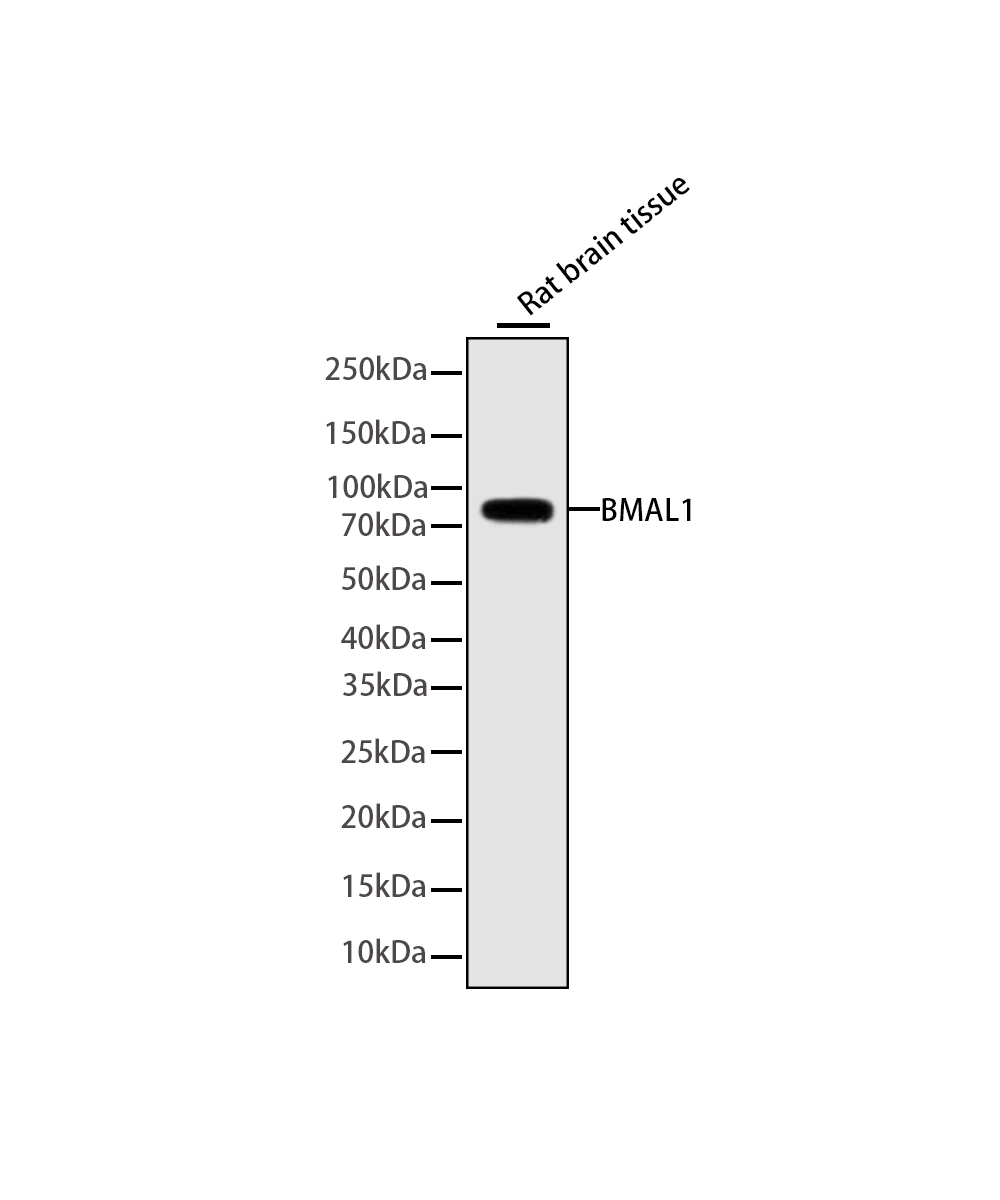 BMAL1 Rabbit mAb