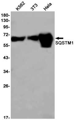 SQSTM1 Rabbit mAb