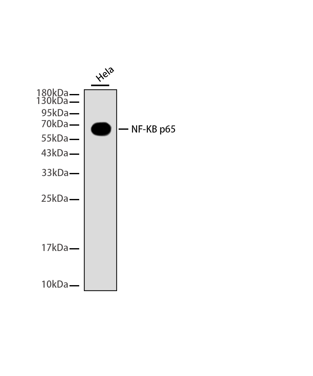 NF-KB p65 Rabbit mAb