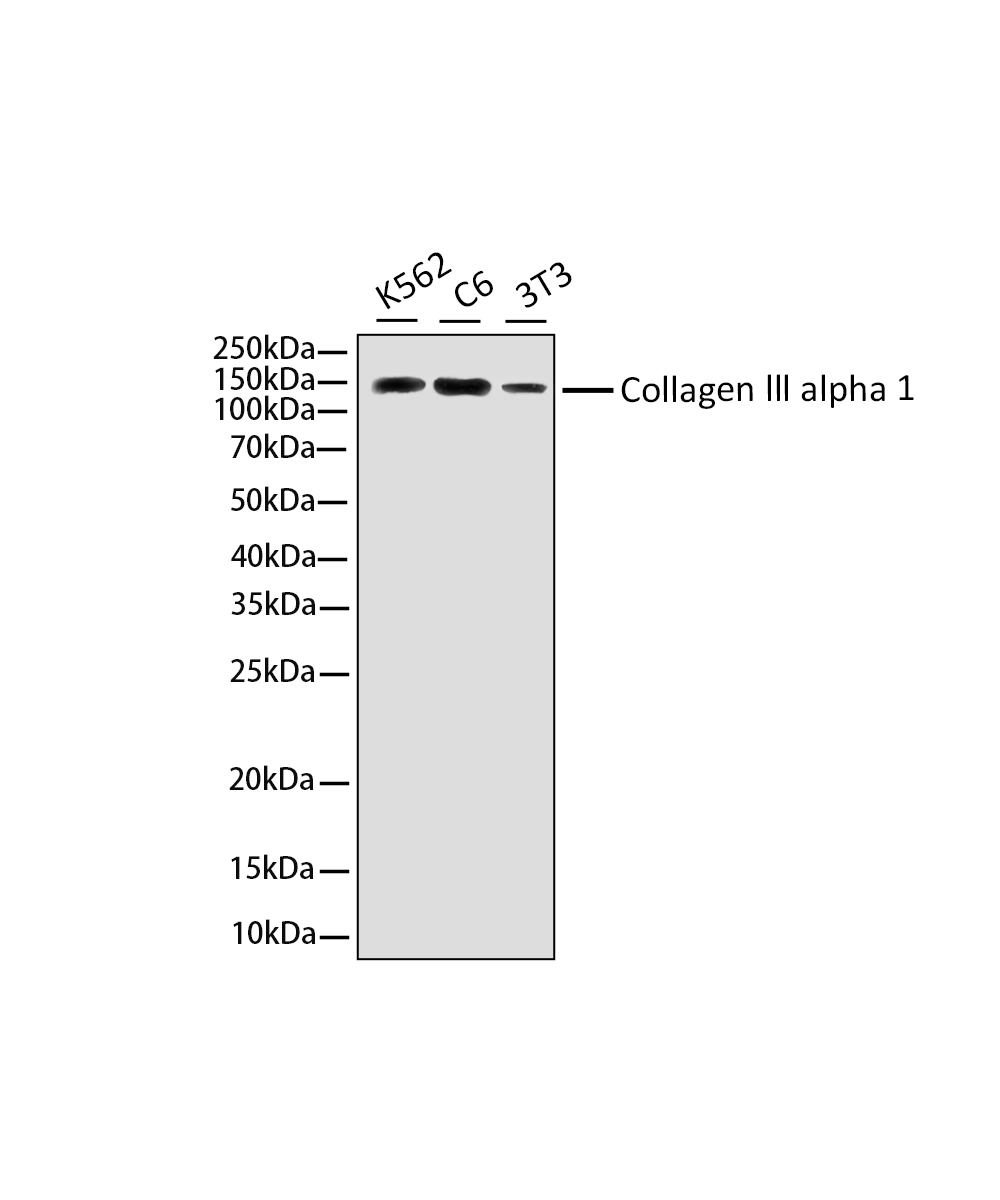 Collagen III alpha 1 Rabbit mAb