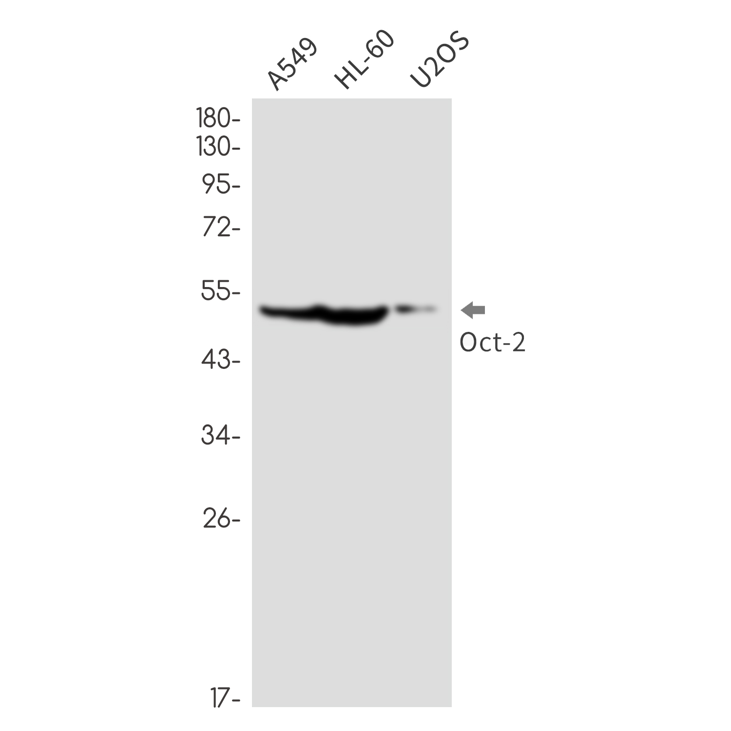 Oct-2 Rabbit mAb