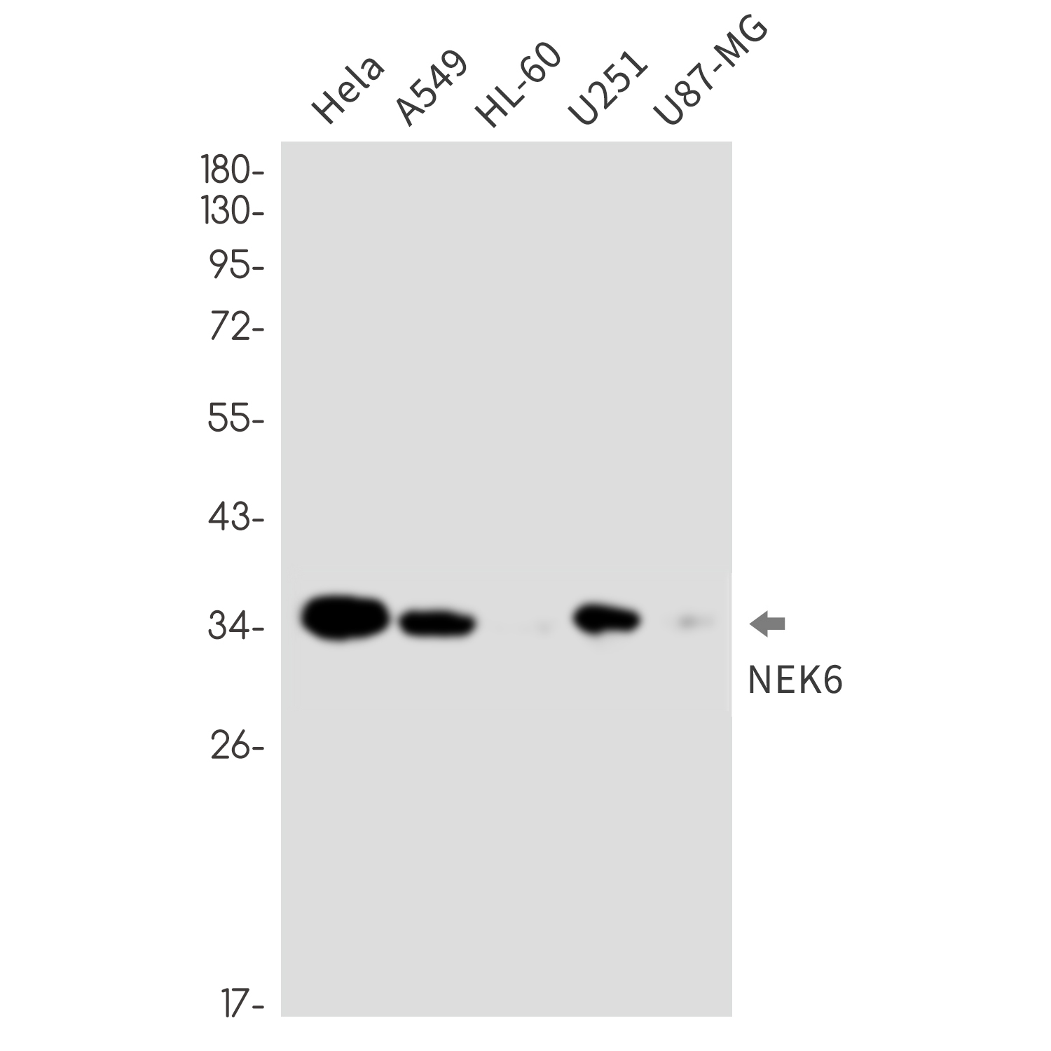 NEK6 Rabbit mAb