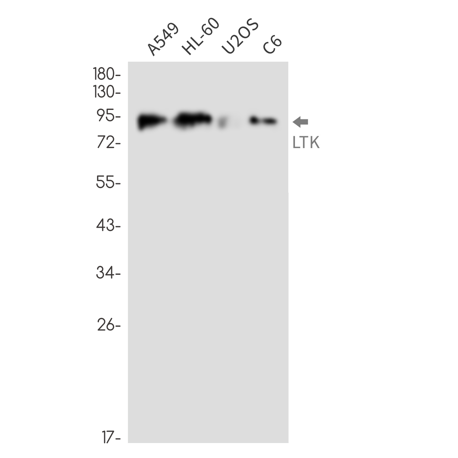 LTK Rabbit mAb