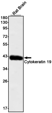 Cytokeratin 19 Rabbit mAb