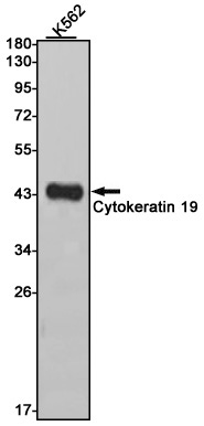 Cytokeratin 19 Rabbit mAb