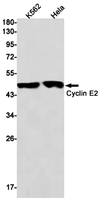Cyclin E2 Rabbit mAb