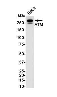ATM Rabbit mAb