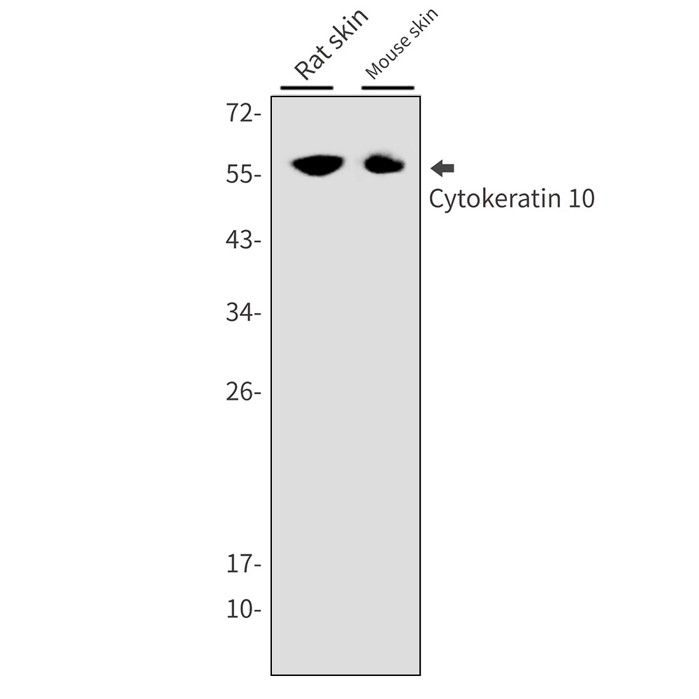 Cytokeratin 10 Rabbit mAb