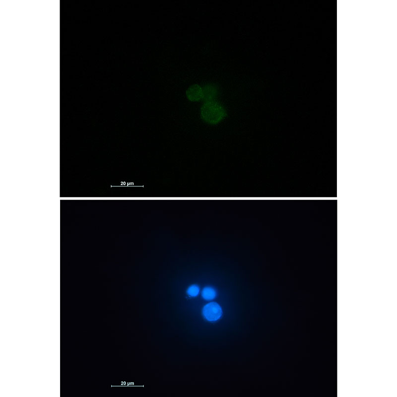 Matrin 3 Rabbit mAb