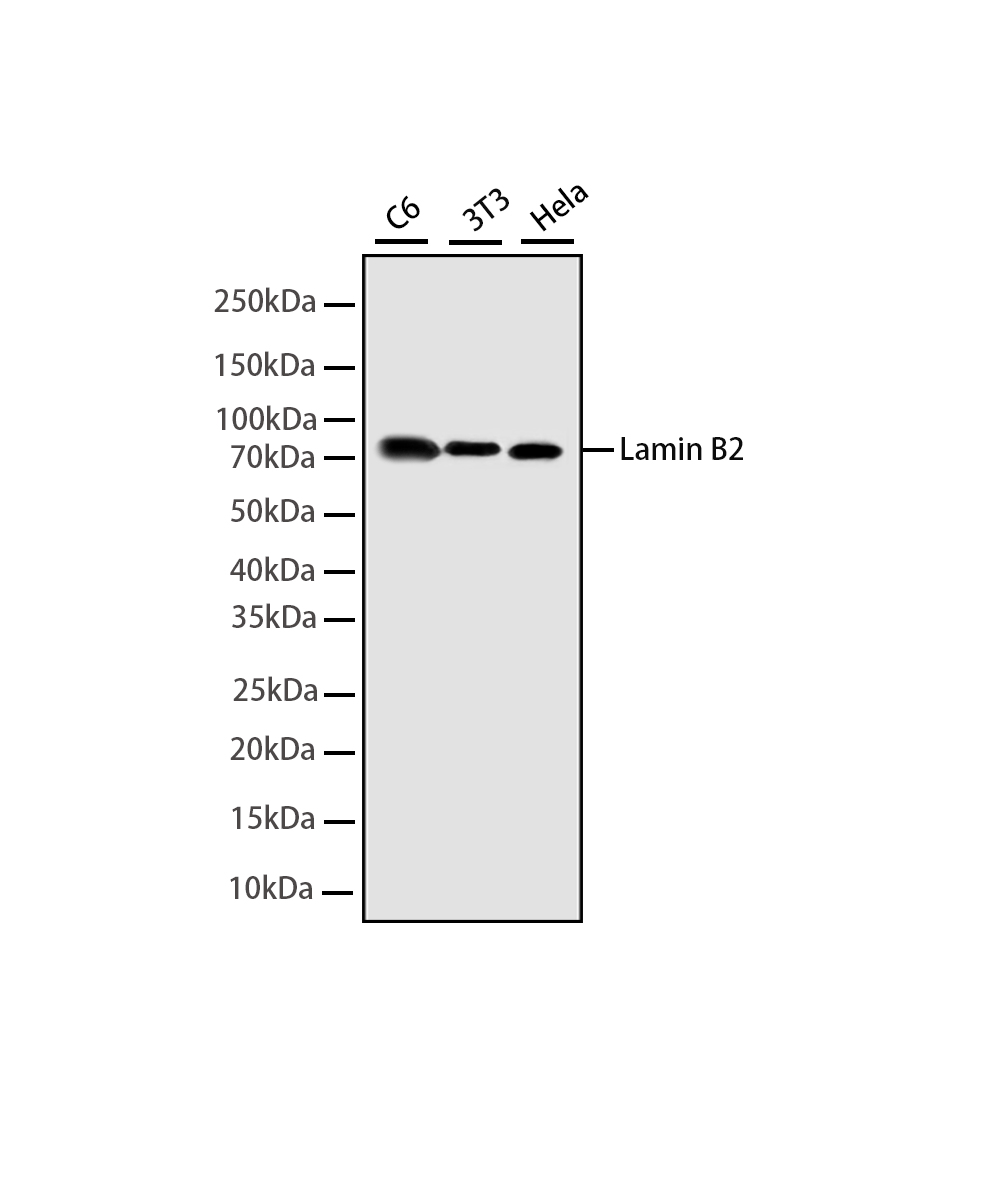 Lamin B2 Rabbit mAb