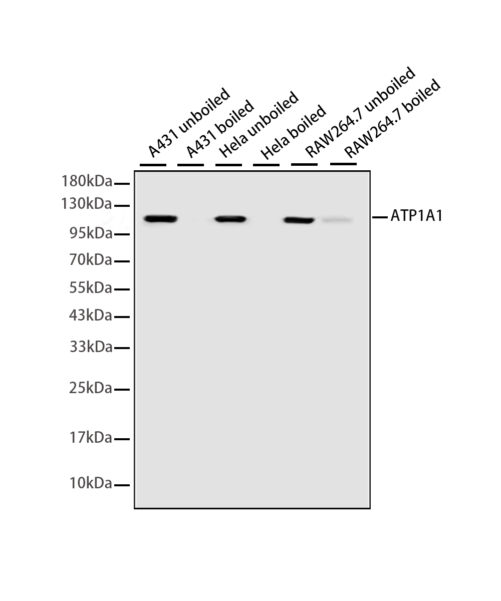 ATP1A1 Rabbit mAb