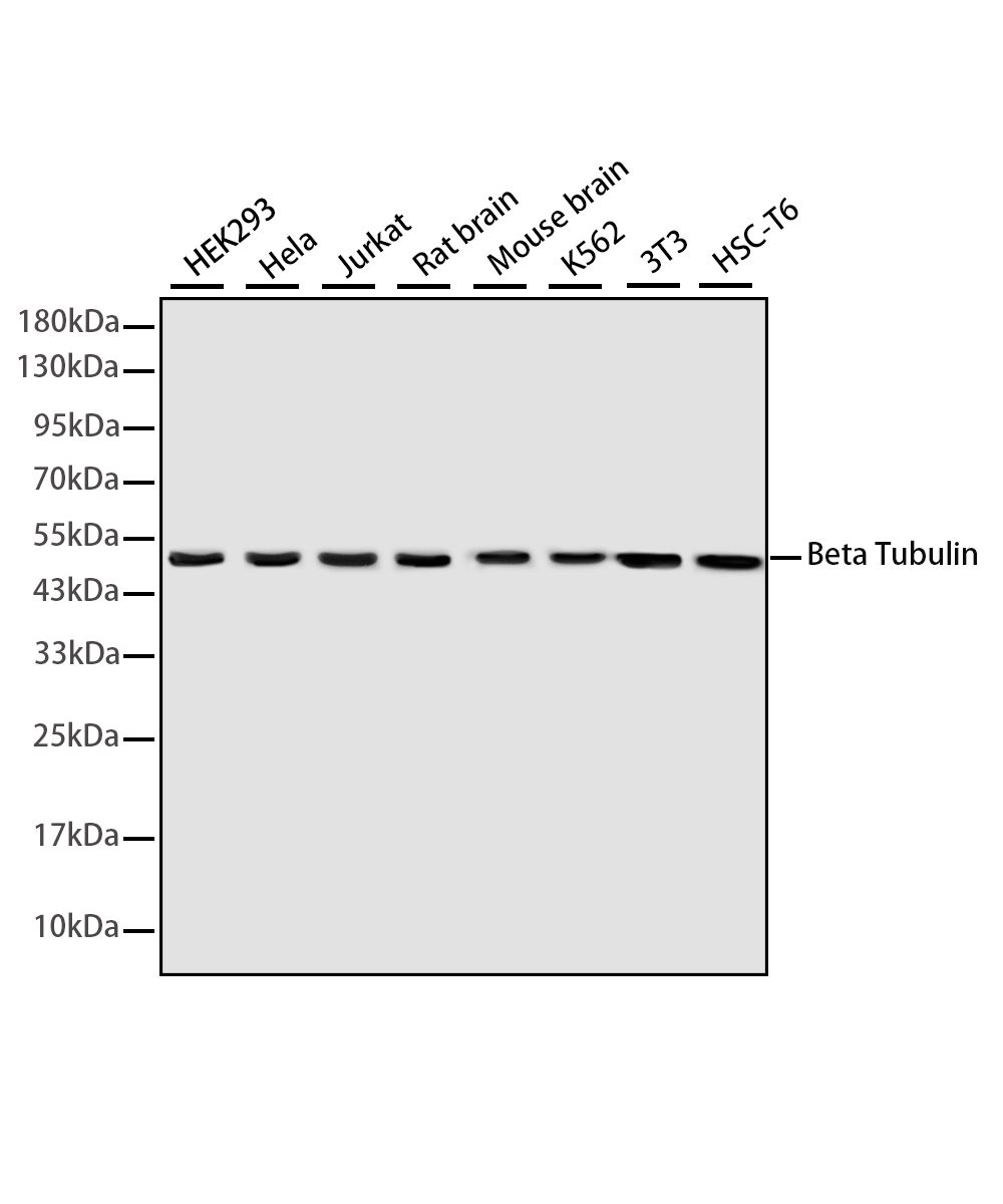 β-tubulin Rabbit mAb